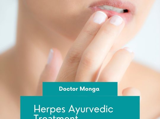 DR Monga Herpes Ayurvedic Medicine in Kaithal, Haryana- Dr Monga