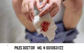 Best doctor for piles in gurgaon +91-8010931122