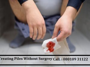 Best doctor for fissure in gurgaon haryana