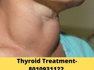 Best Thyroid doctor in Adrash nagar – 8010931122